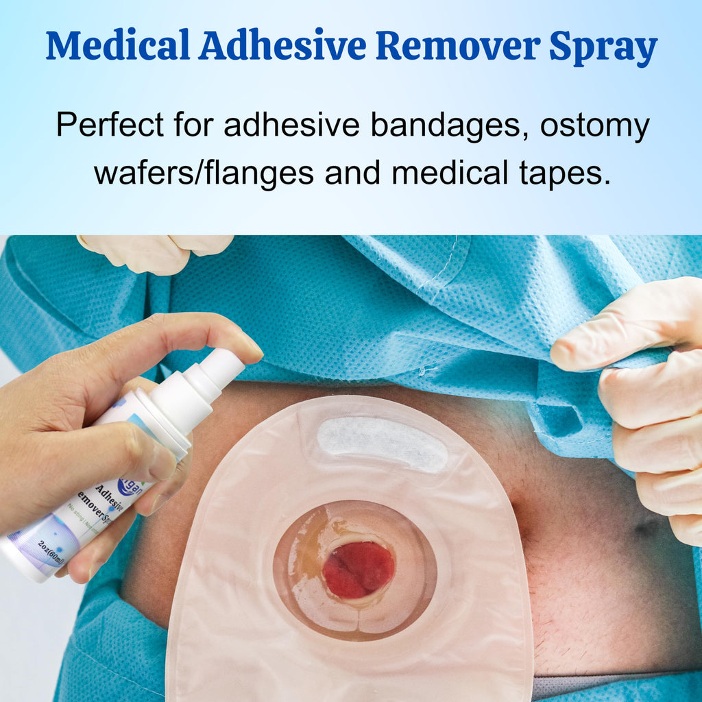 60ml Adhesive Remover Spray U558